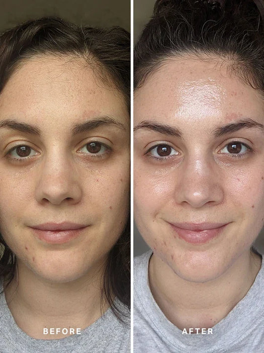 Alpha-H Liquid Gold 100ml